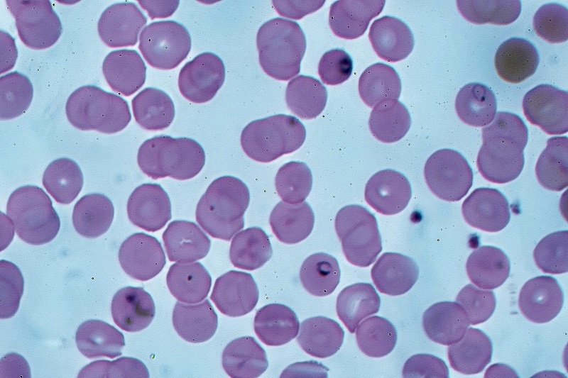 Plasmodium falciparum có thời gian ủ bệnh từ 9 - 14 ngày